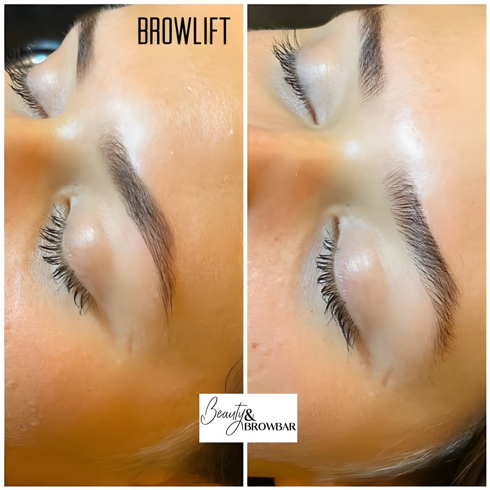Voor en na van een browlift: de wenkbrauwhaartjes staan na de behandeling omhoog gekamd en vol.